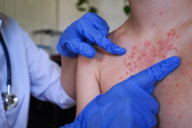 Salvati Copiii Cea mai grava criza de vaccinare din ultimele decenii in Romania Numai 47 dintre
