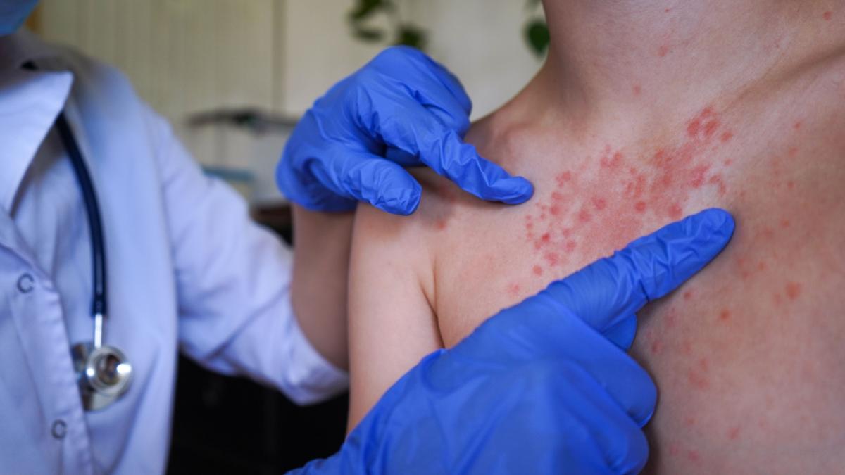 Salvati Copiii Cea mai grava criza de vaccinare din ultimele decenii in Romania Numai 47 dintre