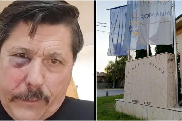Au atacat cu ura pentru a ma ucide un consilier local aur a fost internat in spital cu o fractura faciala