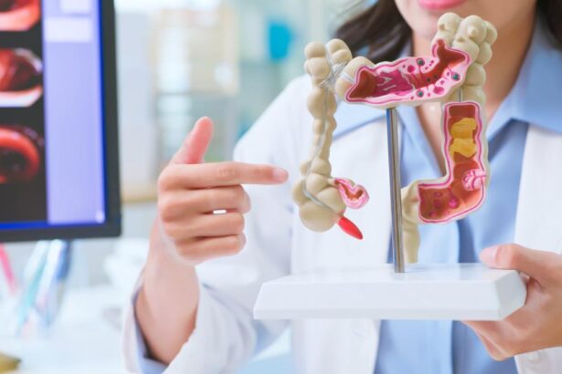 De ce tot mai multi tineri sunt diagnosticai cu cancer de colon In unele tari acesta a devenit principala cauza de deces
