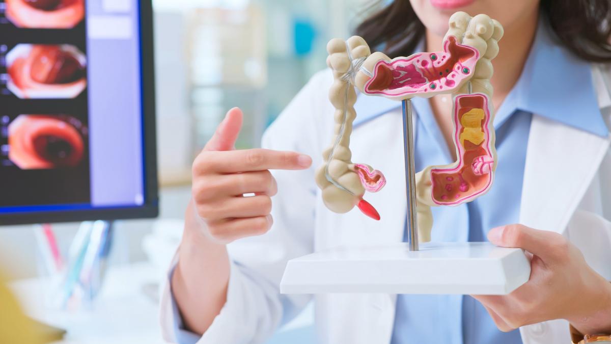 De ce tot mai multi tineri sunt diagnosticai cu cancer de colon In unele tari acesta a devenit principala cauza de deces